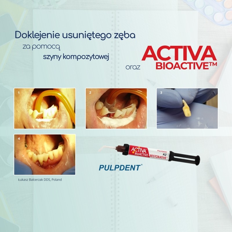 ACTIVA BioACTIVE - Restorative - bioaktywne wypełnienie