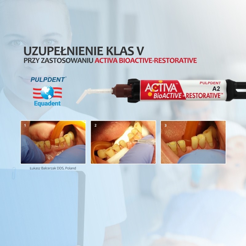 ACTIVA BioACTIVE - Restorative - bioaktywne wypełnienie