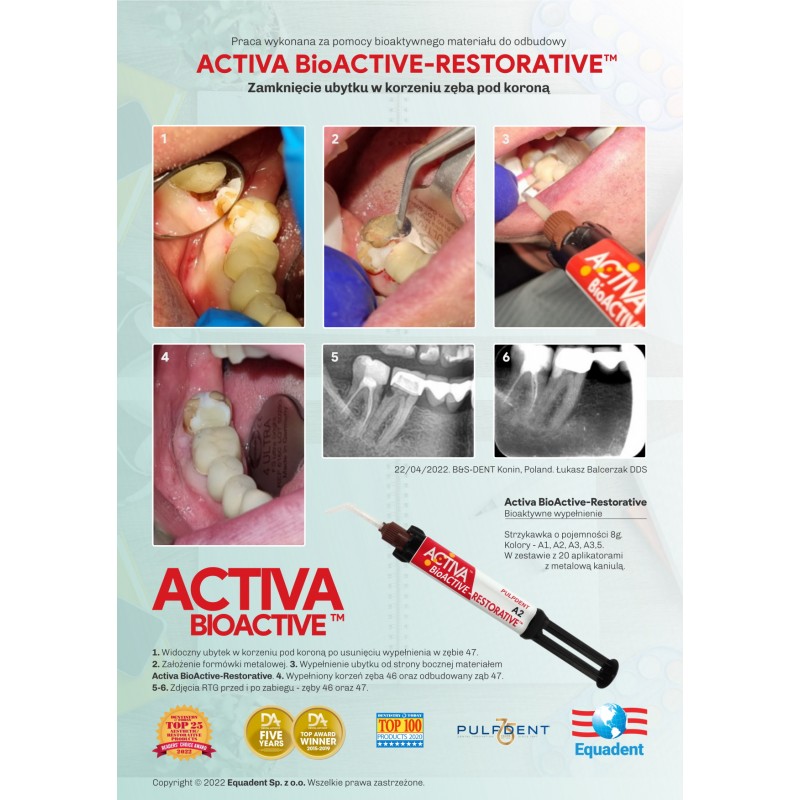 ACTIVA BioACTIVE - Restorative - bioaktywne wypełnienie