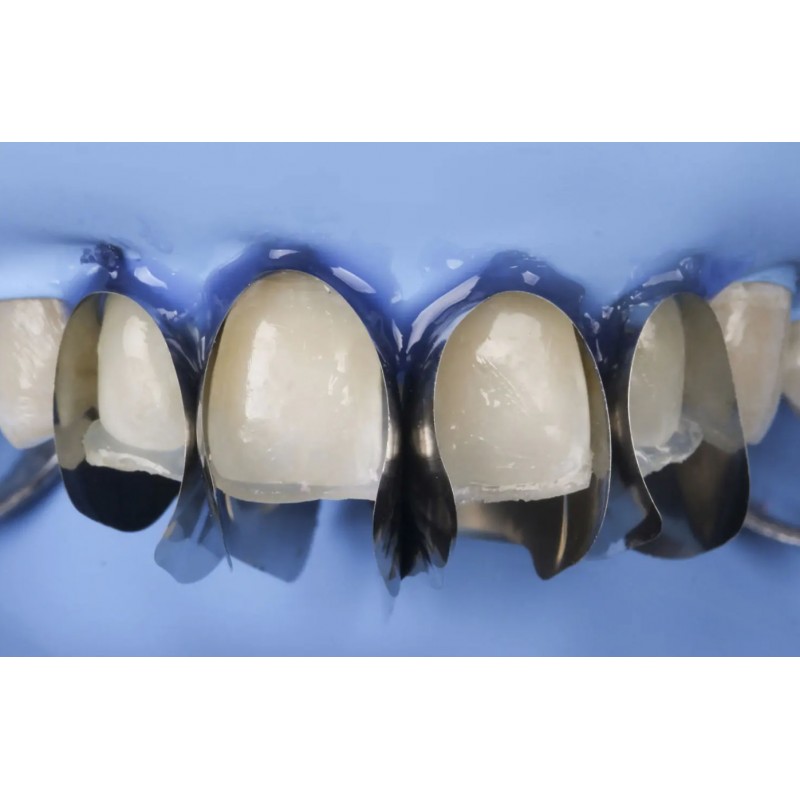 Unica Anterior MiniDeep - matryce do wypełnień przednich przy bondingu